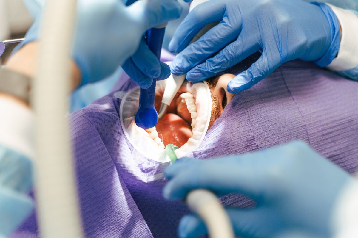 7 Tips for a Smooth Root Canal Treatment Recovery in Bartlesville, OK