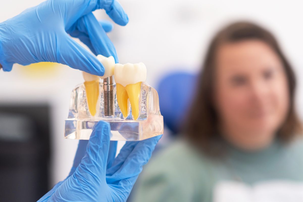 Are Dental Implants Safe? Insights from a Bartlesville Dentist
