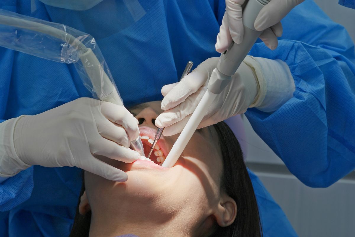 How to Treat Bleeding Gums