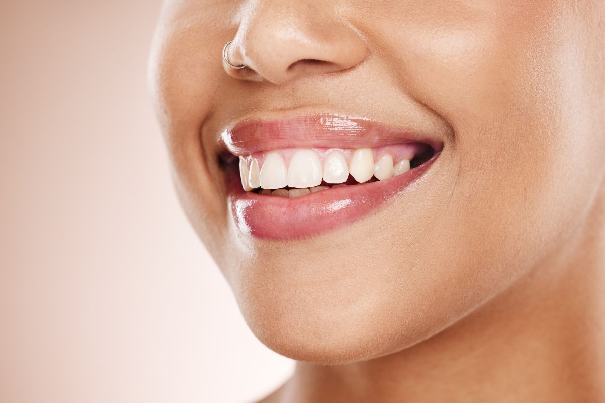 how long does teeth whitening last