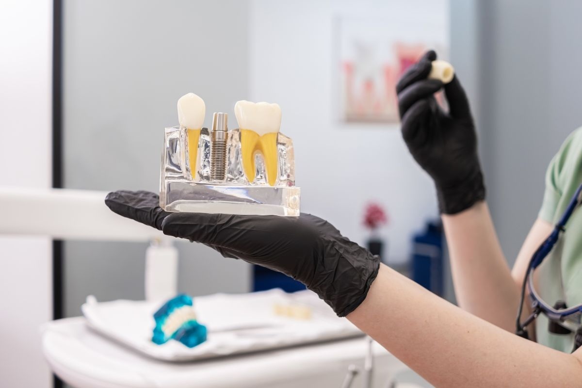Dental professional holding educational model showing dental implant components and tooth restoration options.